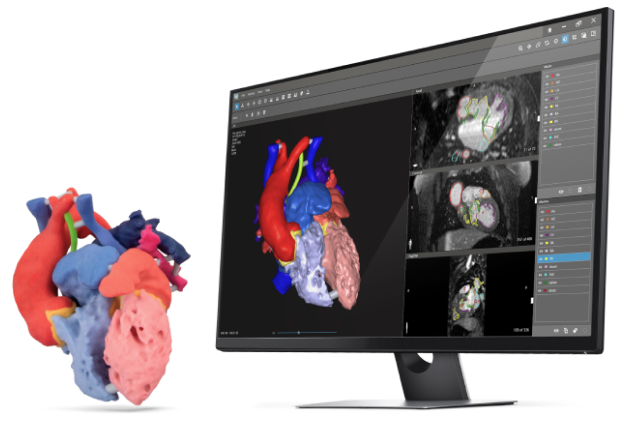 3D 医学图像分割软件