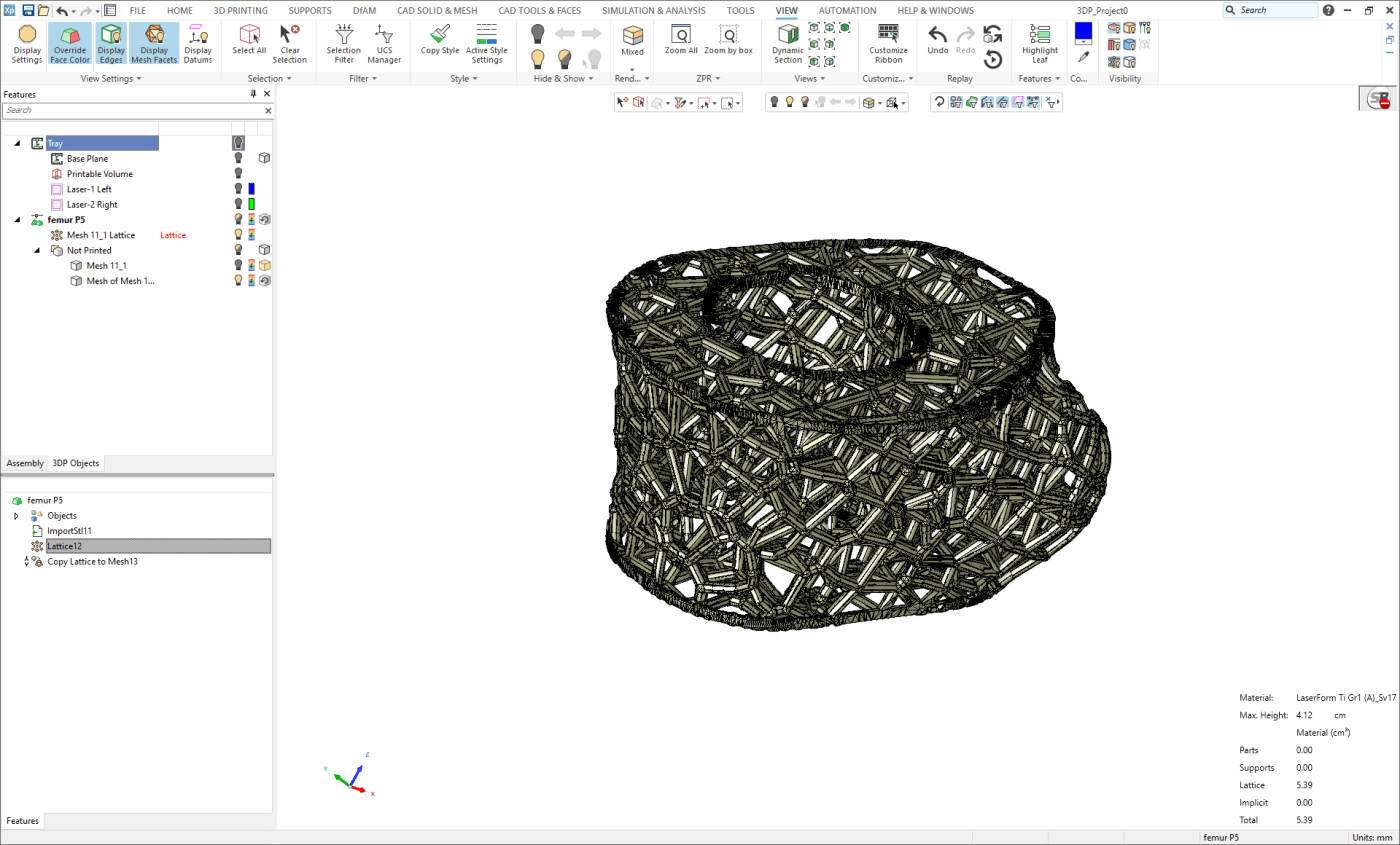 3DXpert 中带有网格的股骨植入件的 3MF 数据