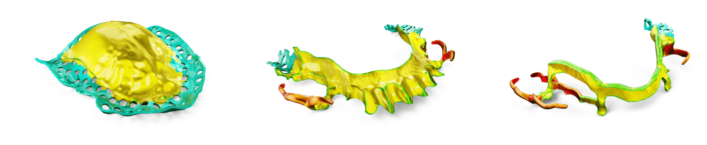 3DprintedRPDs