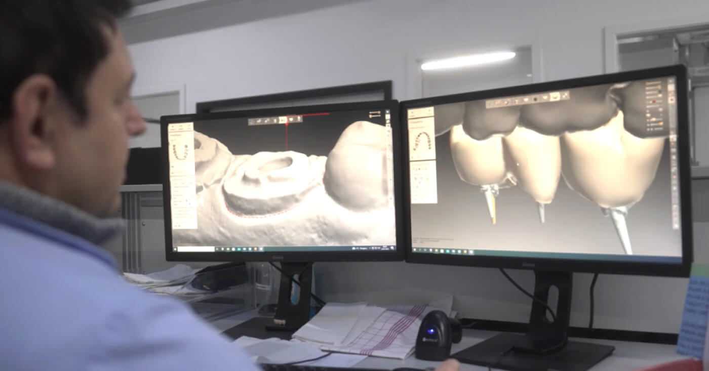 dentalCADsoftware